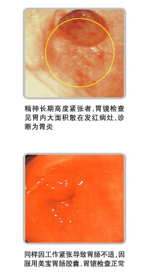 �Ϲ�NG��28(�й���)����Ʒ���������޹�˾